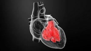 What Does It Mean to Have an Enlarged Heart?