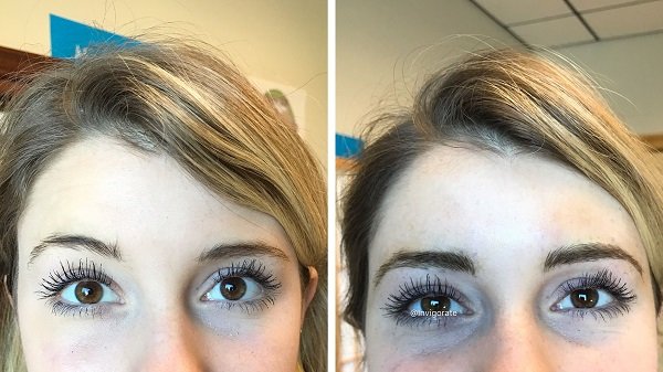 The way to Repair Uneven Eyebrows: Medical doctors Recommendation!