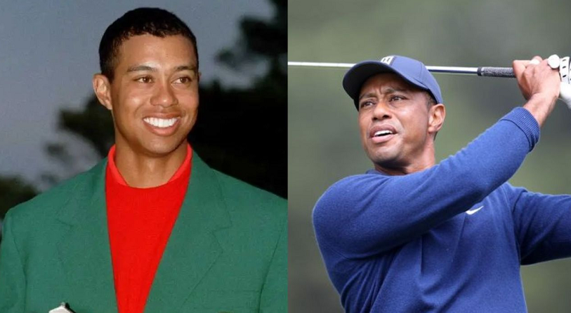 Has Tiger Woods Had Plastic Surgery